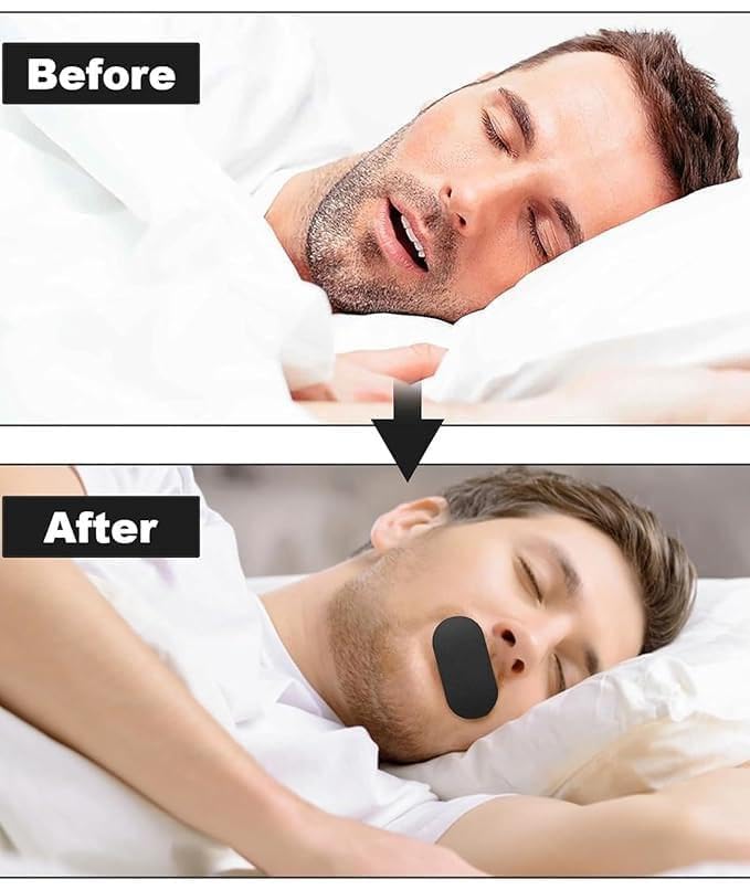 Premium Anti-Snoring Mouth Tape (CL-96)