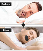 Premium Anti-Snoring Mouth Tape (CL-96)