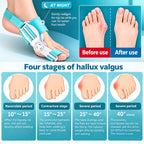 Toe Straightener Bunion Corrector for Women & Men  (CL-98)