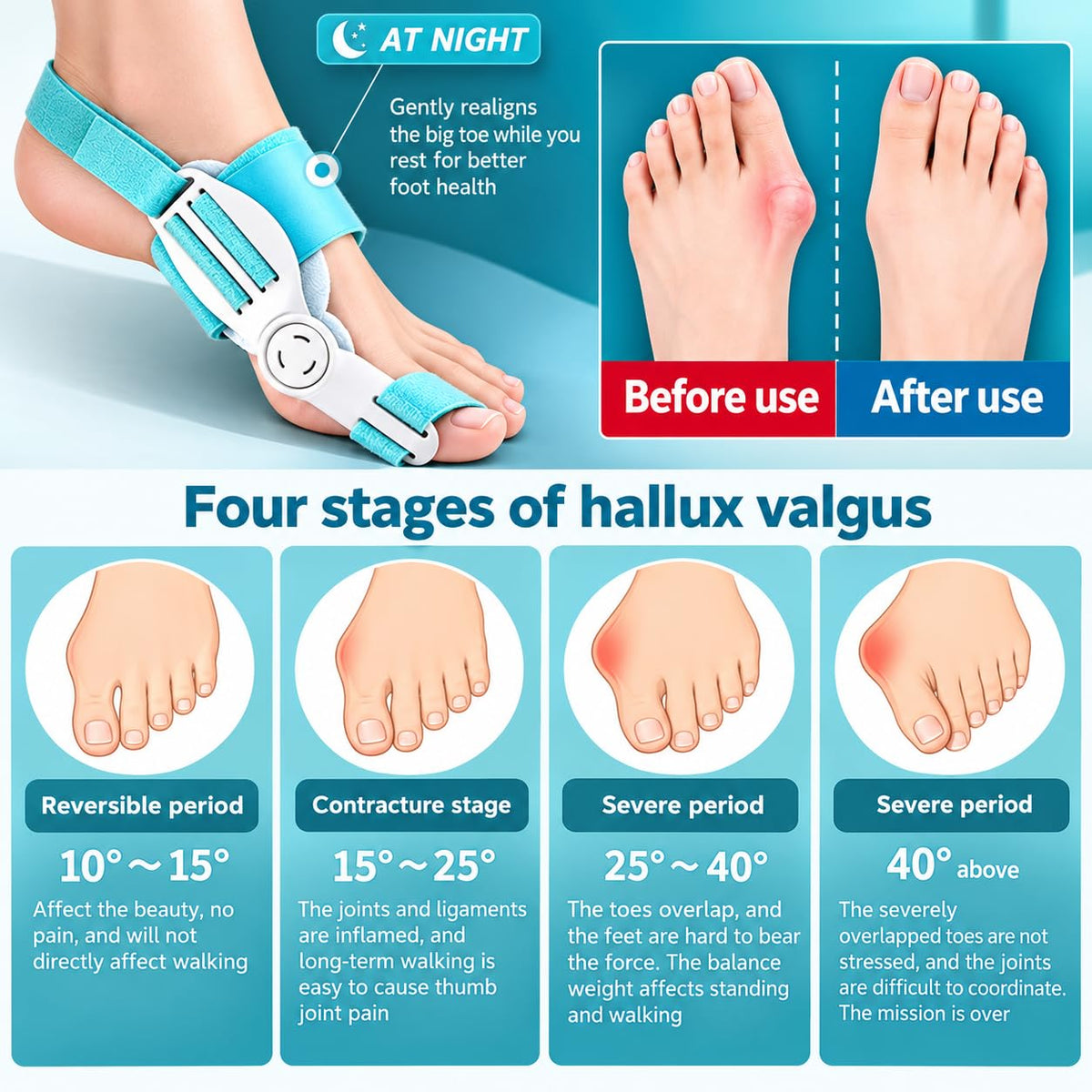 Toe Straightener Bunion Corrector for Women & Men  (CL-98)